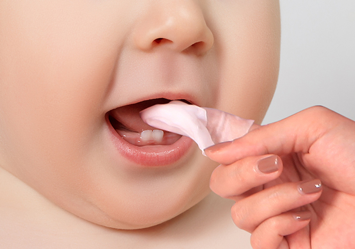 Vệ sinh răng miện không sạch là nguyên nhân gây ra viêm amidan ở trẻ